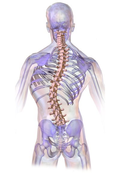 Scoliosis_02.jpg